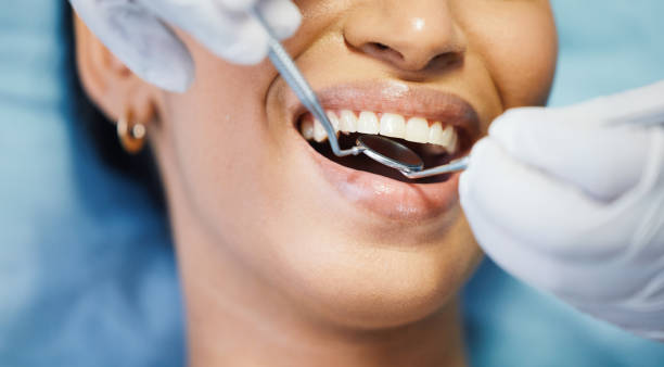 Best Broken or Chipped Tooth Repair in Industry, PA
